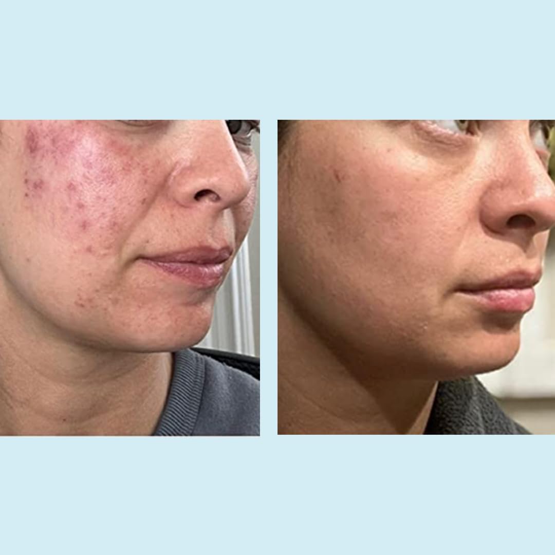 Perfect Image skin texture visual suggests smoother surface after use.
