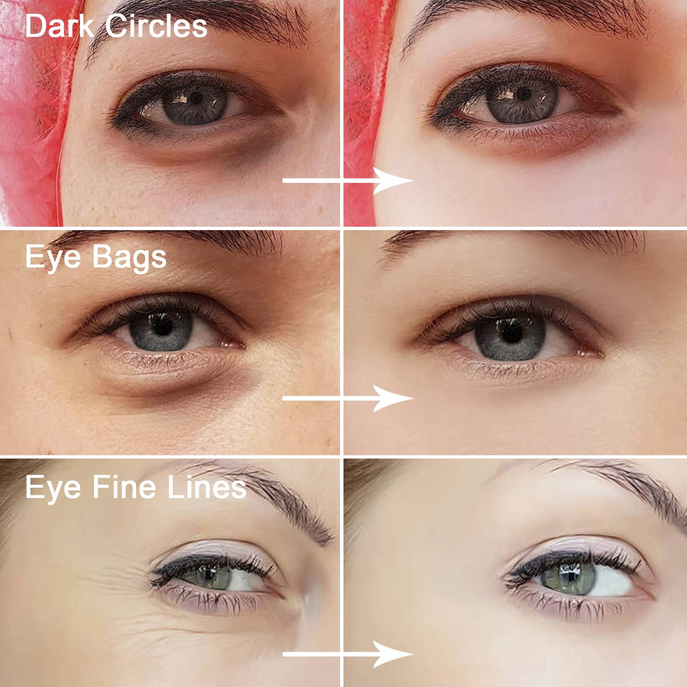 Permotary colágeno para reafirmar la piel alrededor de los ojos