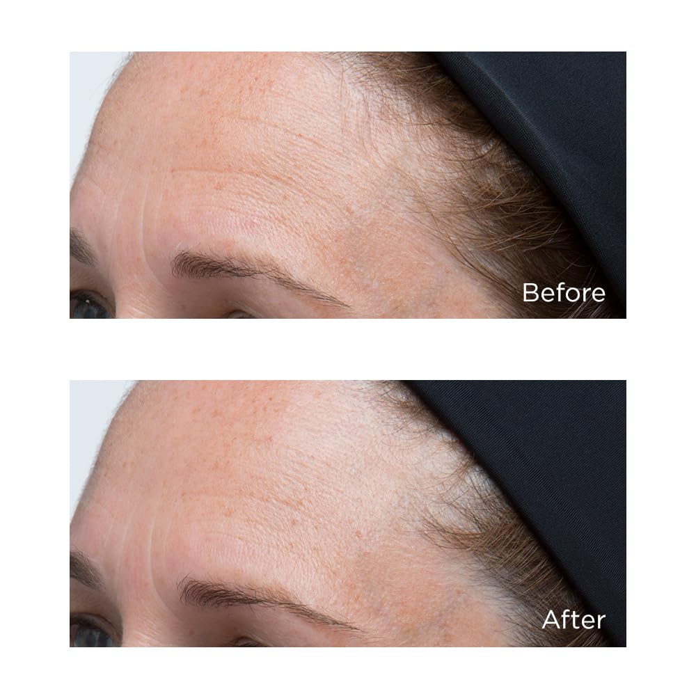 Packaging box and jar branding from Perricone MD Hyaluronic Intensive Moisturizer.