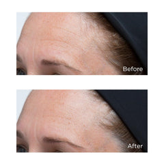 Packaging box and jar branding from Perricone MD Hyaluronic Intensive Moisturizer.