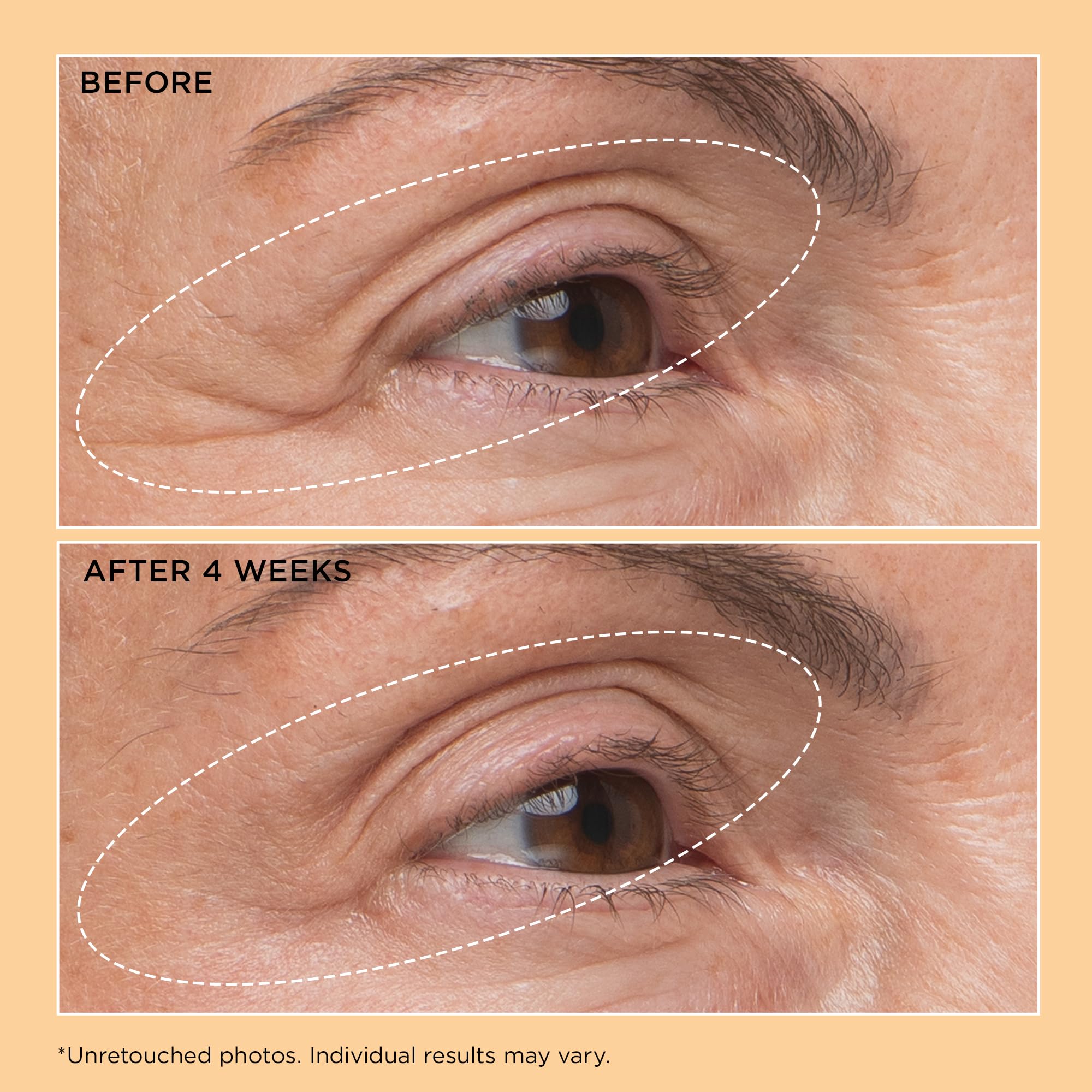 Perricone MD Neuropeptide eyelid lift serum helps reduce crepiness around eyes