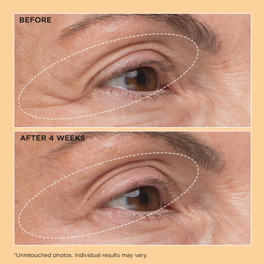 Perricone MD Neuropeptide eyelid lift serum helps reduce crepiness around eyes