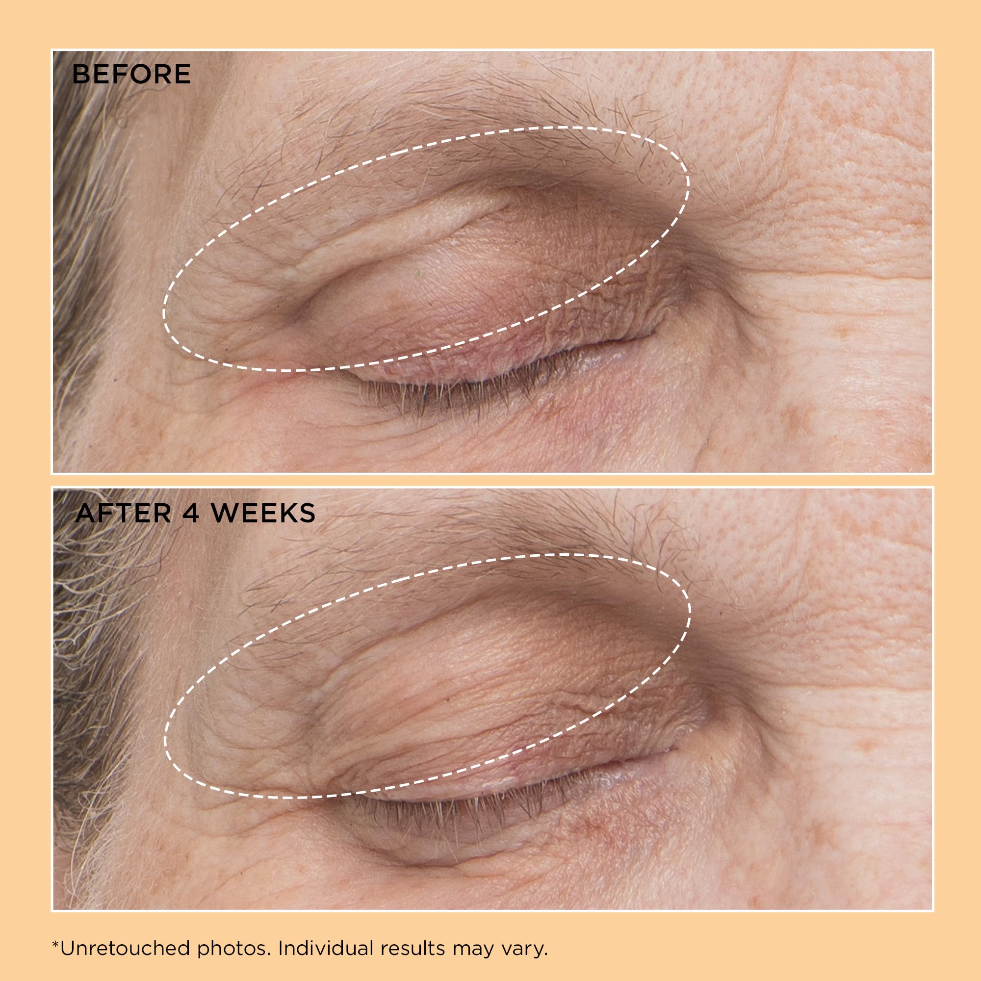 Perricone MD Neuropeptide eyelid lift serum premium packaging