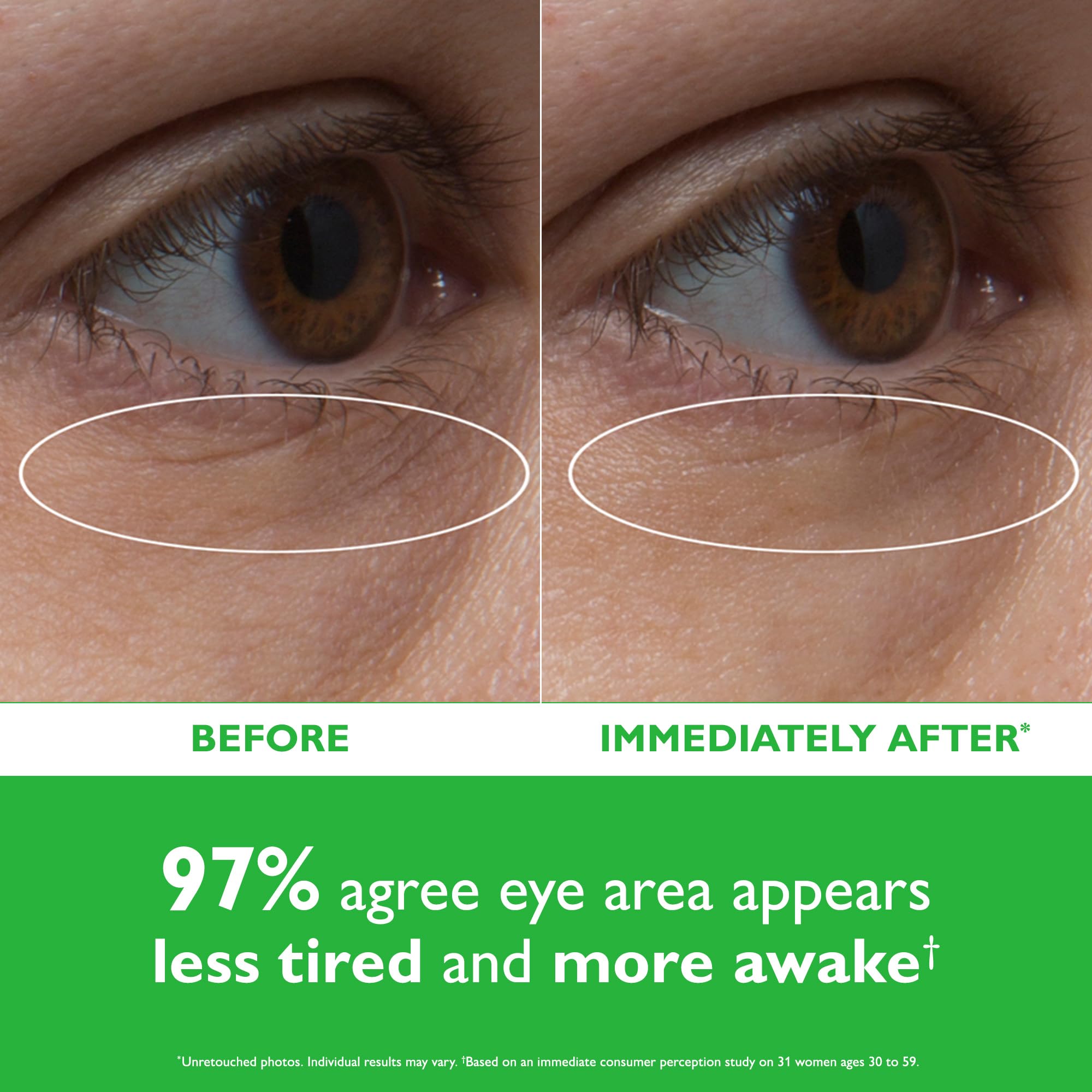 Applying Peter Thomas Roth cucumber detox eye patches for soothing under-eye relief
