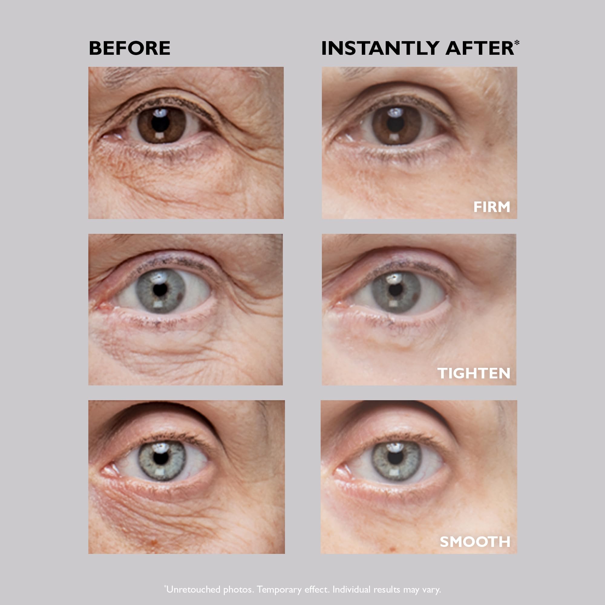 Close-up of fine lines minimized by formula