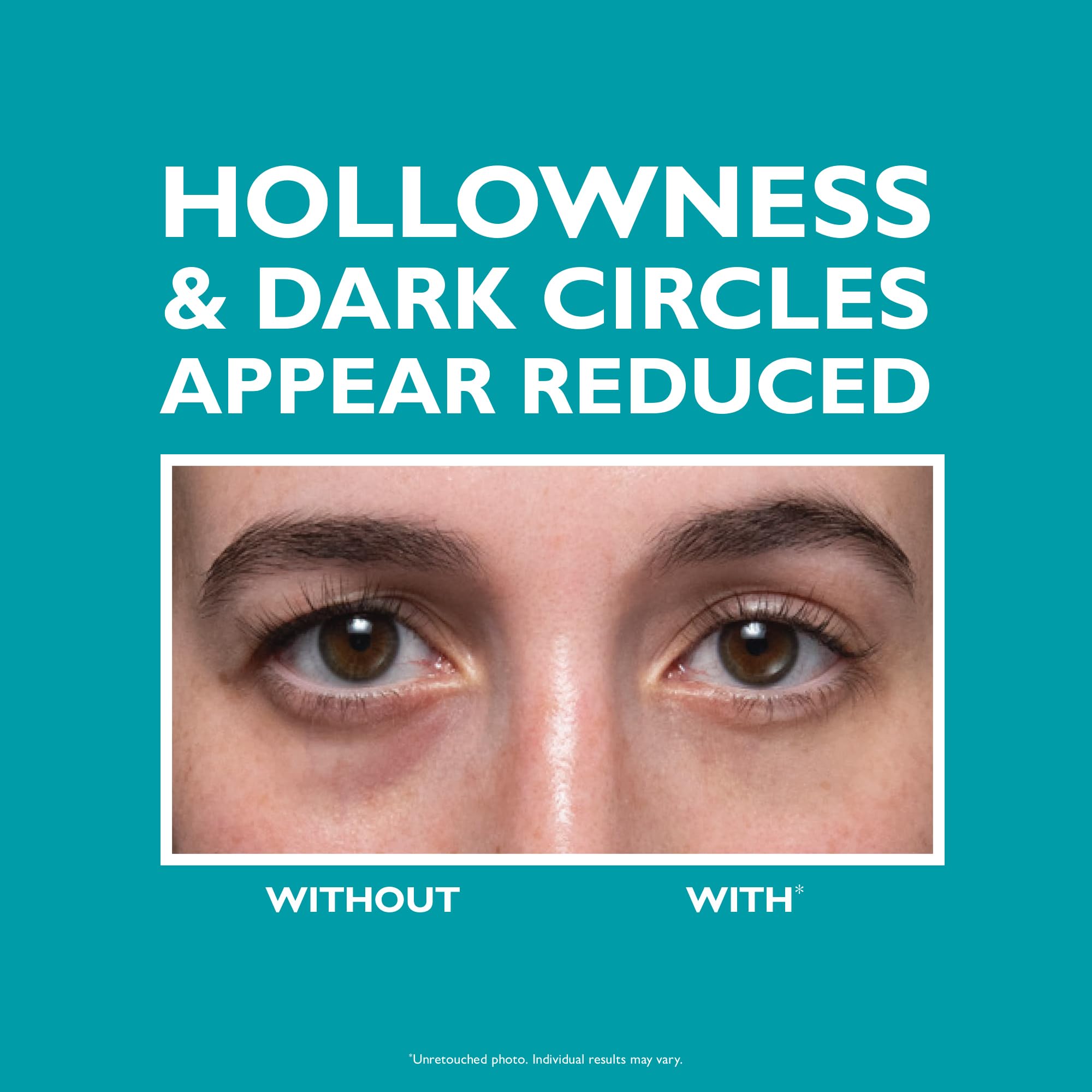 Peter Thomas Roth hyaluronic acid filling spheres closeup highlights plumping texture.
