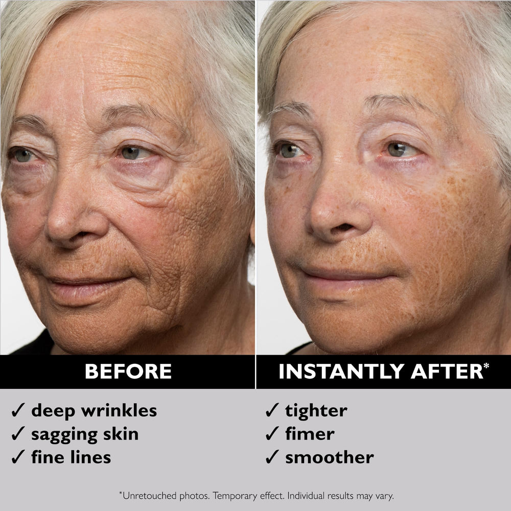 Peter Thomas Roth Instant FirmX Tightener nasolabial-folds area suggests tightened mid-face