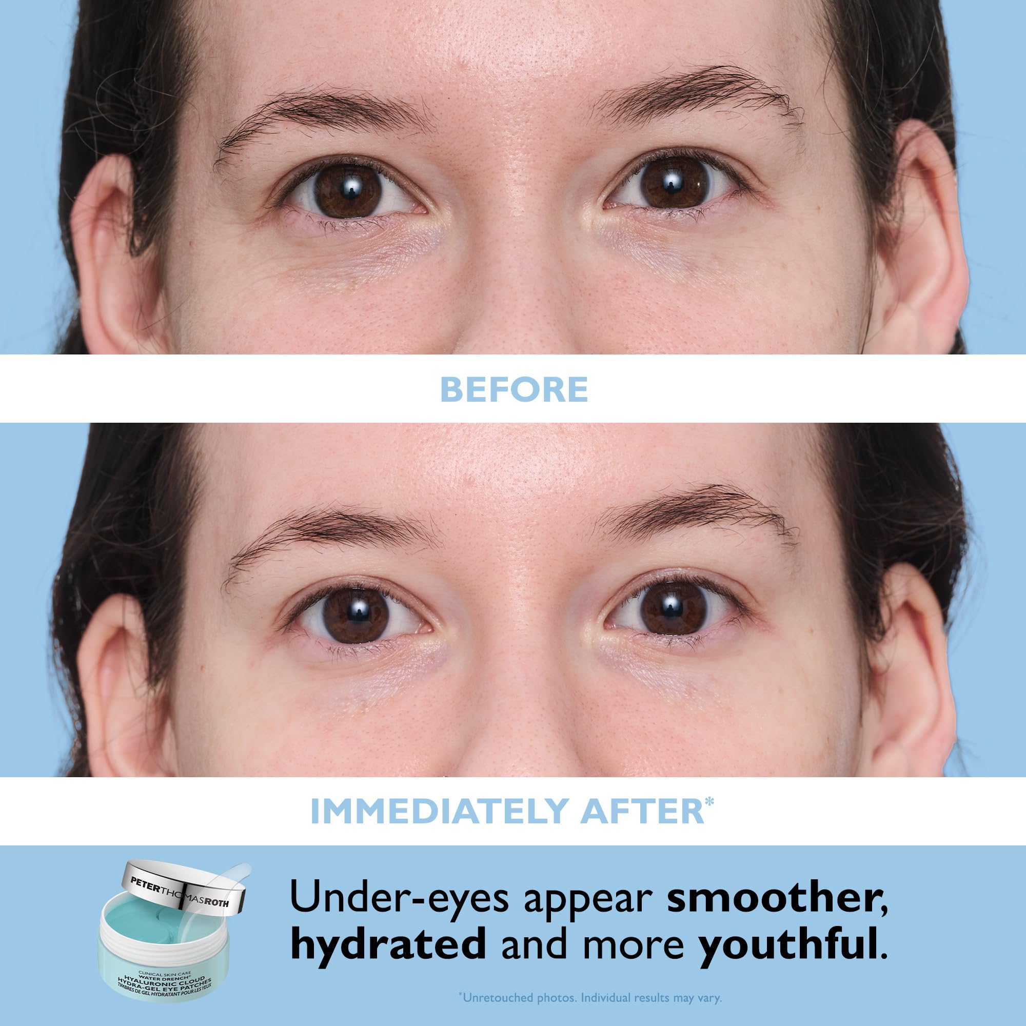 Peter Thomas Roth Eye Patch Kit display with full-size patches.