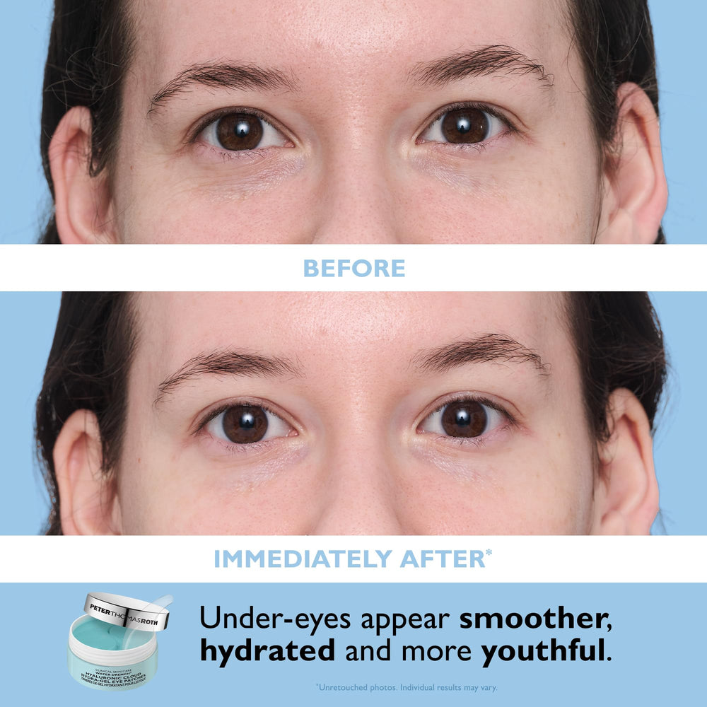 Peter Thomas Roth Eye Patch Kit display with full-size patches.