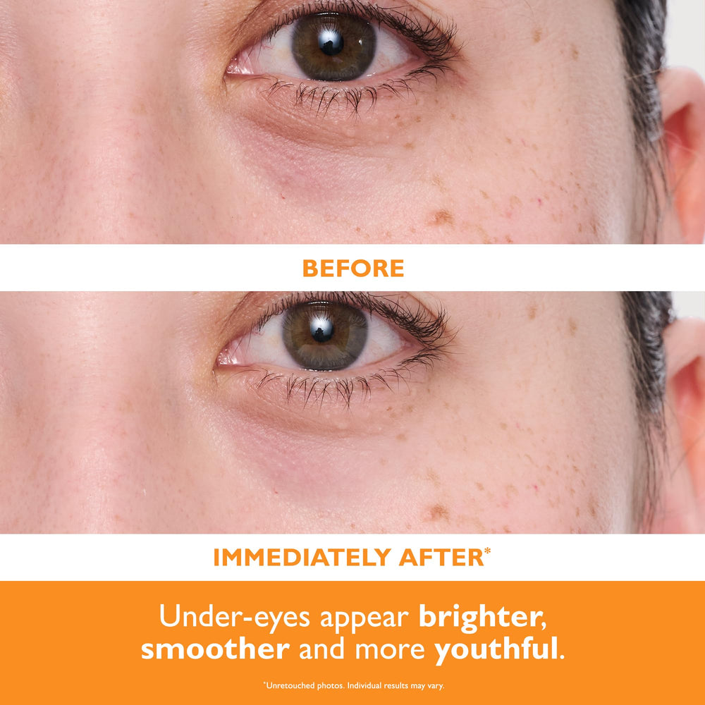 Peter Thomas Roth packaging detail highlights premium eye care solution.