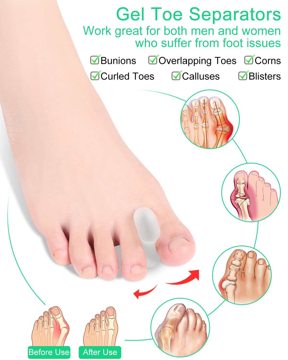 PGRODE large-size toe spacers help separate all toes on both feet.