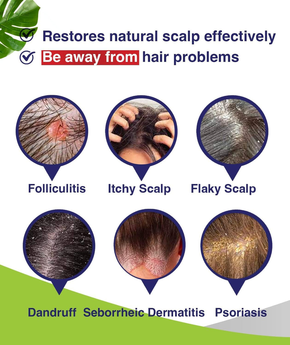 PHARMBANNER anti-fungal shampoo pouring into palm during scalp massage for relief.