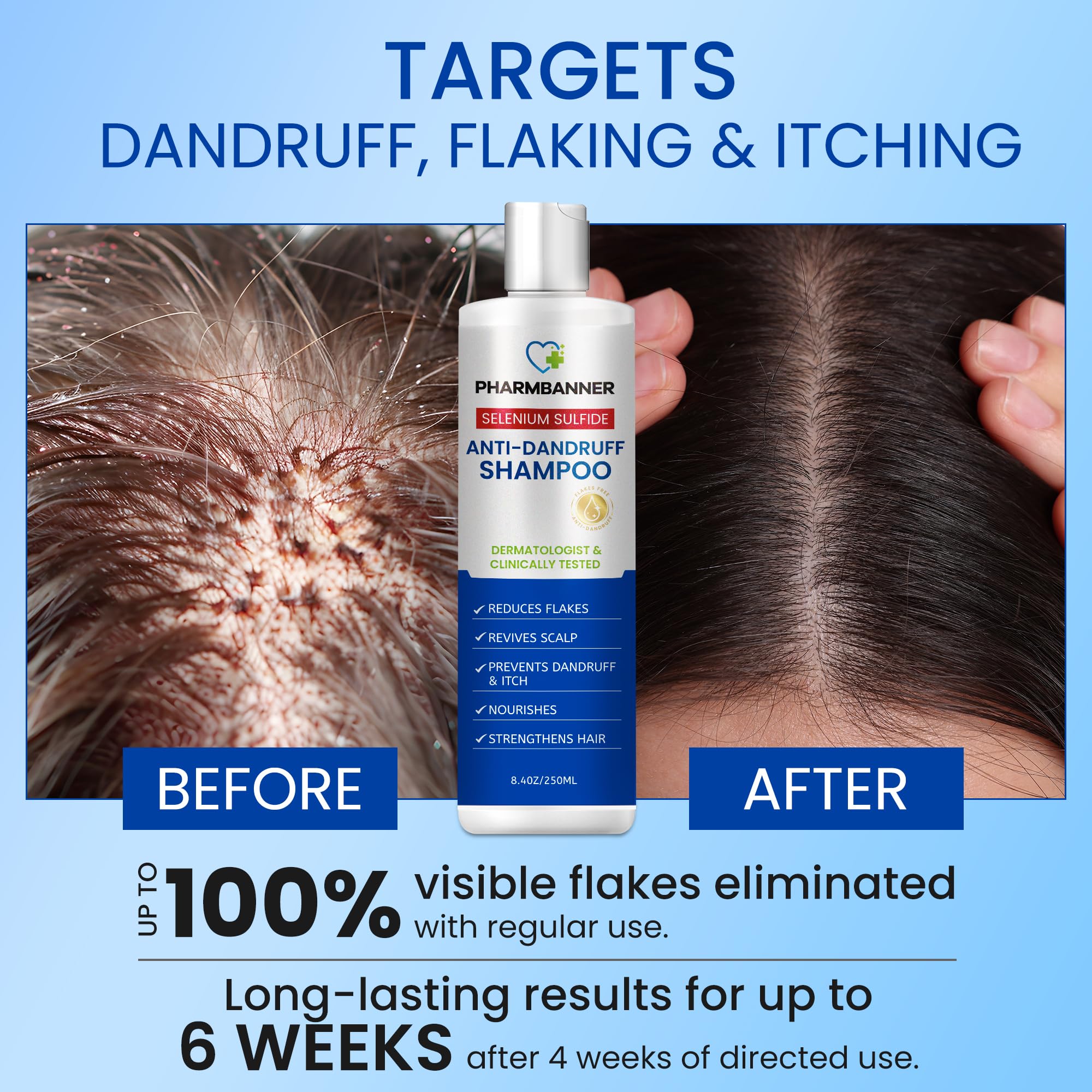 PHARMBANNER selenium sulfide active ingredient graphic explains dandruff-fighting action.