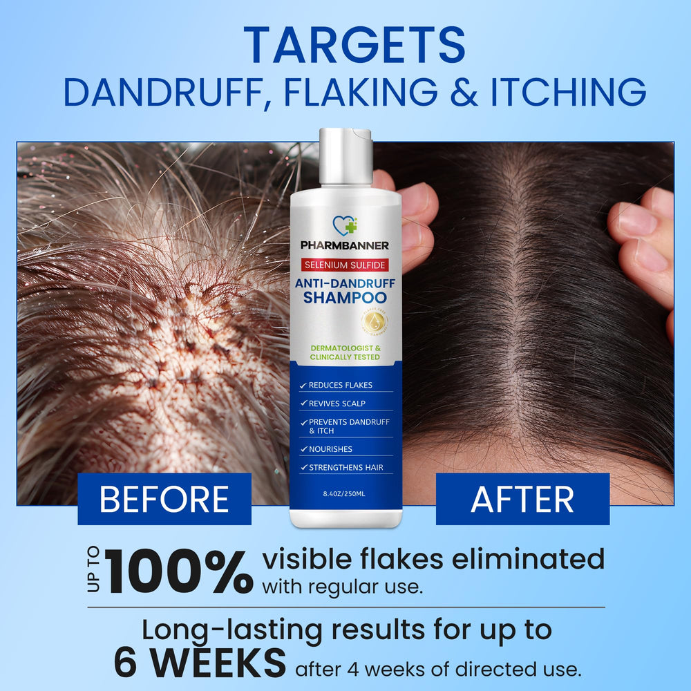 PHARMBANNER selenium sulfide active ingredient graphic explains dandruff-fighting action.
