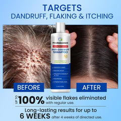 PHARMBANNER selenium sulfide active ingredient graphic explains dandruff-fighting action.