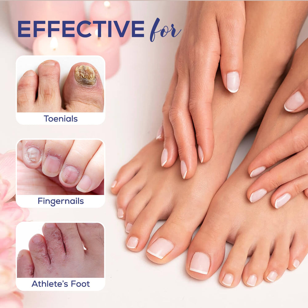 PHARMBANNER complete nail care kit ready for daily routine.