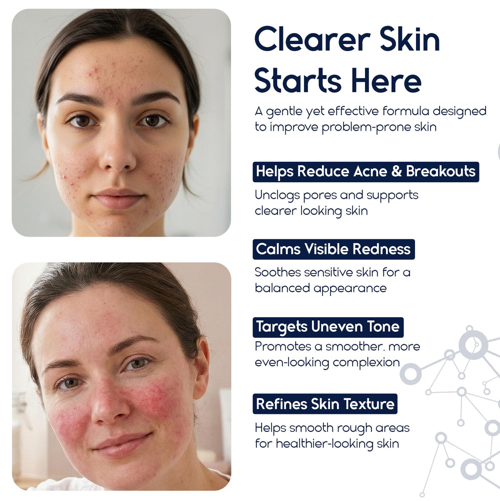 Pharmlitalia Azelaic Acid 15 bottle suggesting redness relief potential