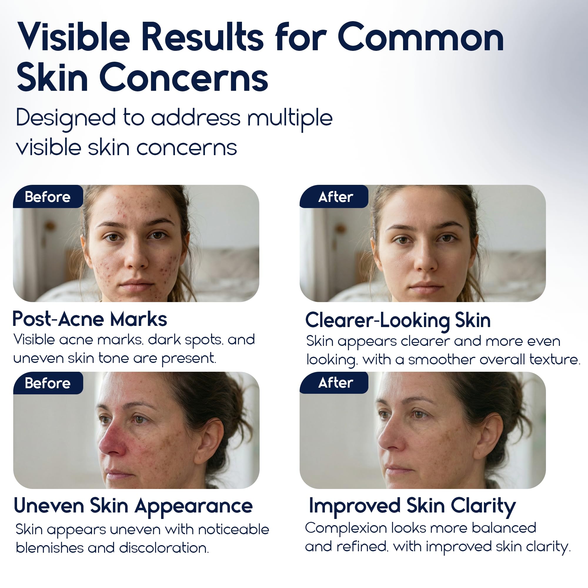 Pharmlitalia Azelaic Acid 15 cream swirl for even tone