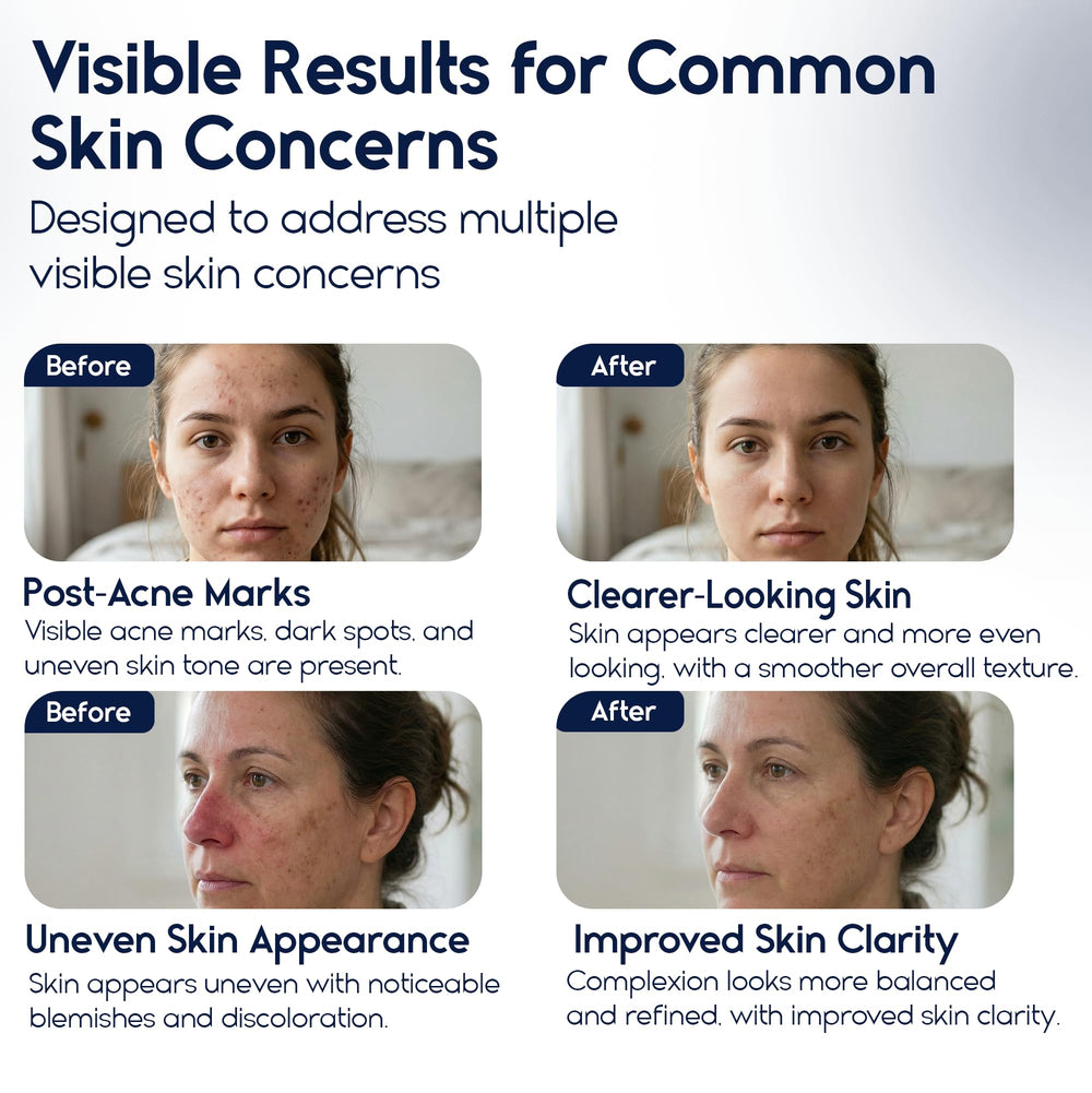 Pharmlitalia Azelaic Acid 15 cream swirl for even tone