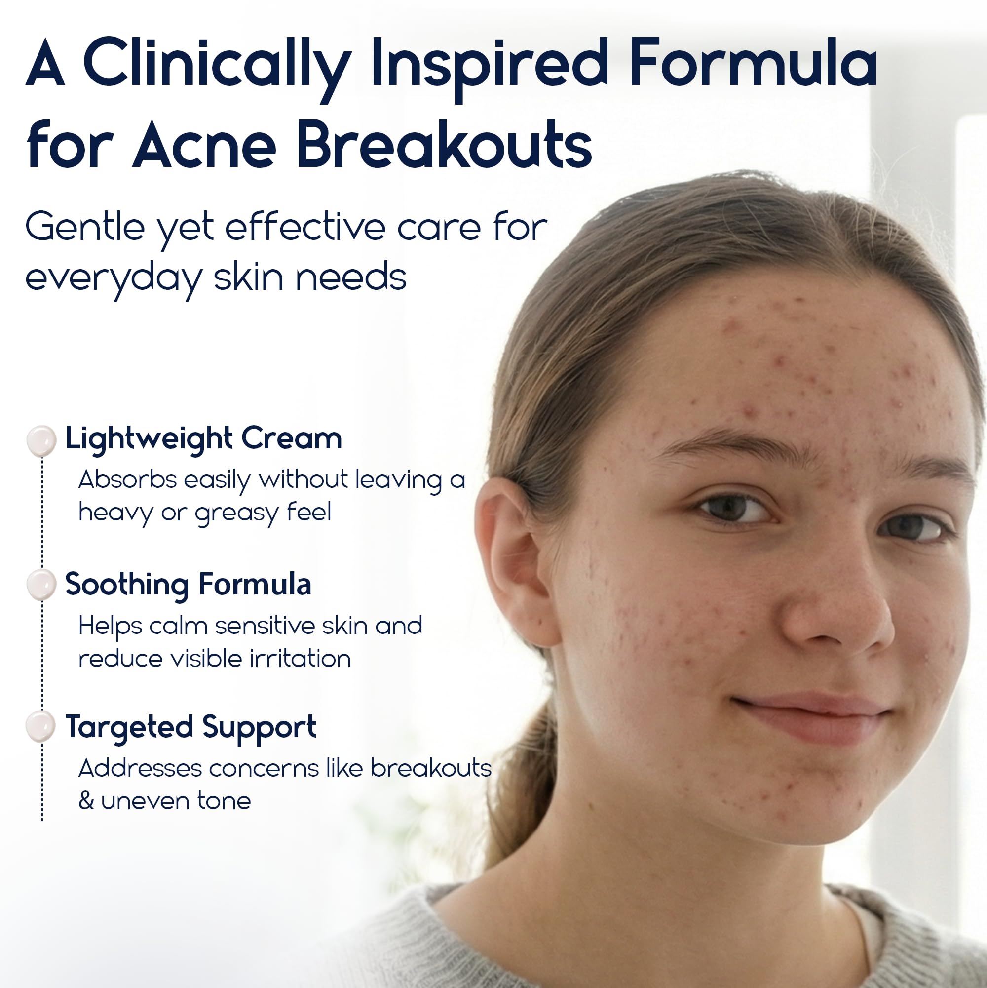 Pharmlitalia Azelaic Acid 15 cream texture close-up for smoother skin