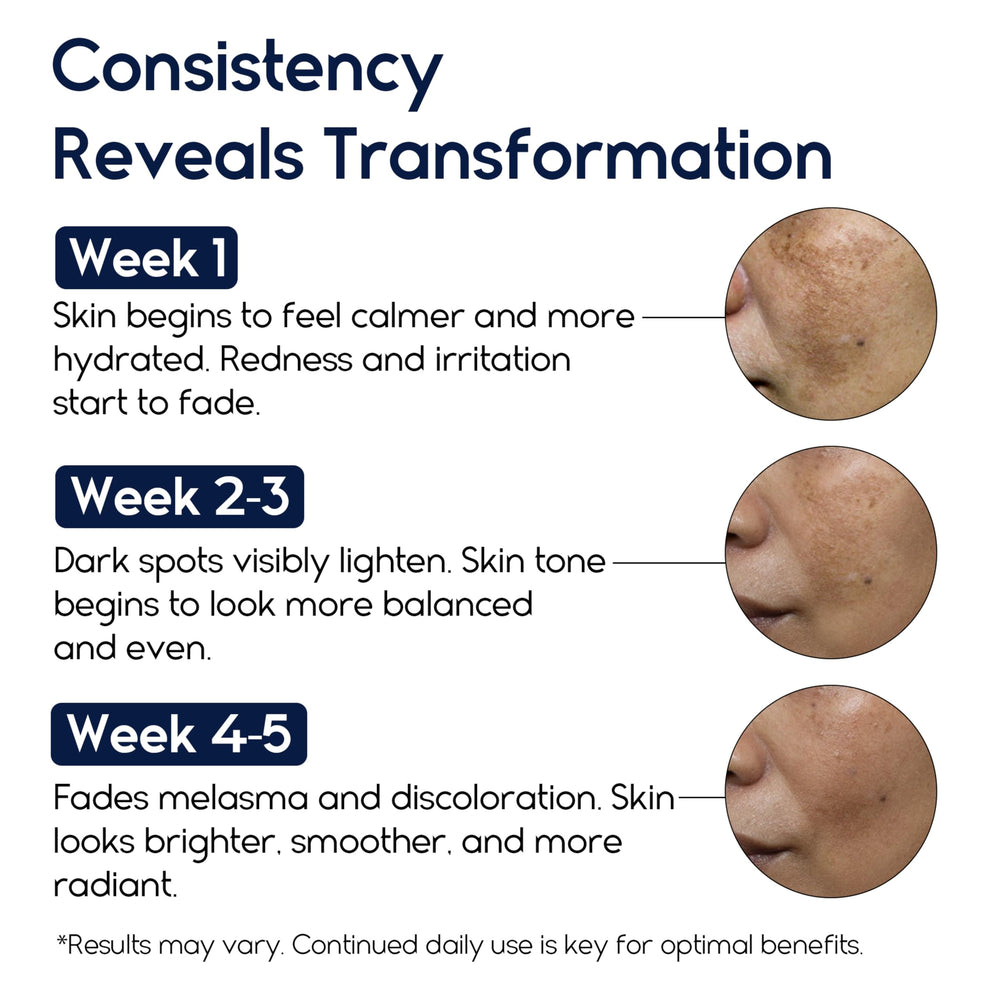 Pharmlitalia Meladerm face cream swirl demonstrates easy spreading for even coverage