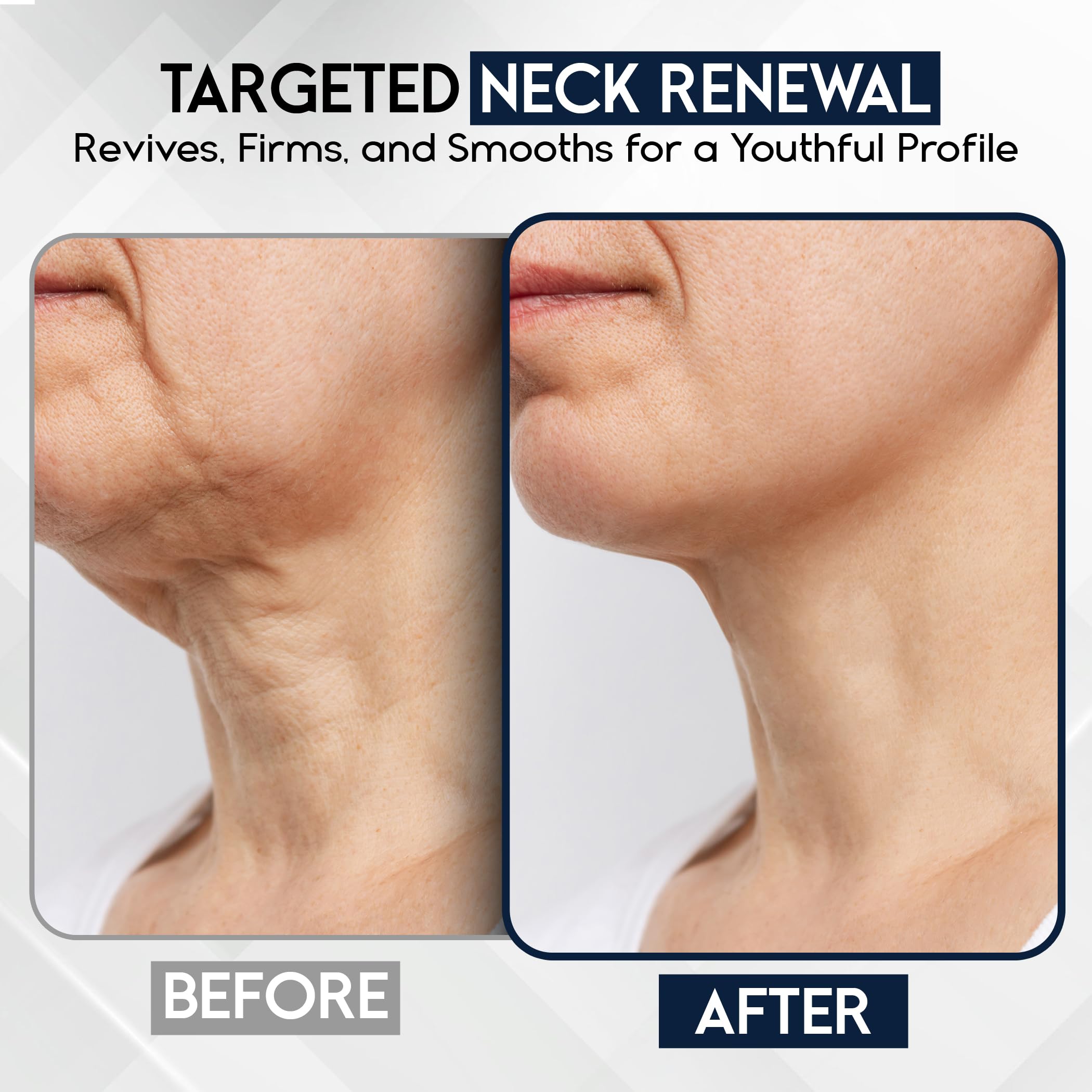 Pharmlitalia Rostro-Cuello-Escote crema: combate arrugas y mejora textura de la piel.