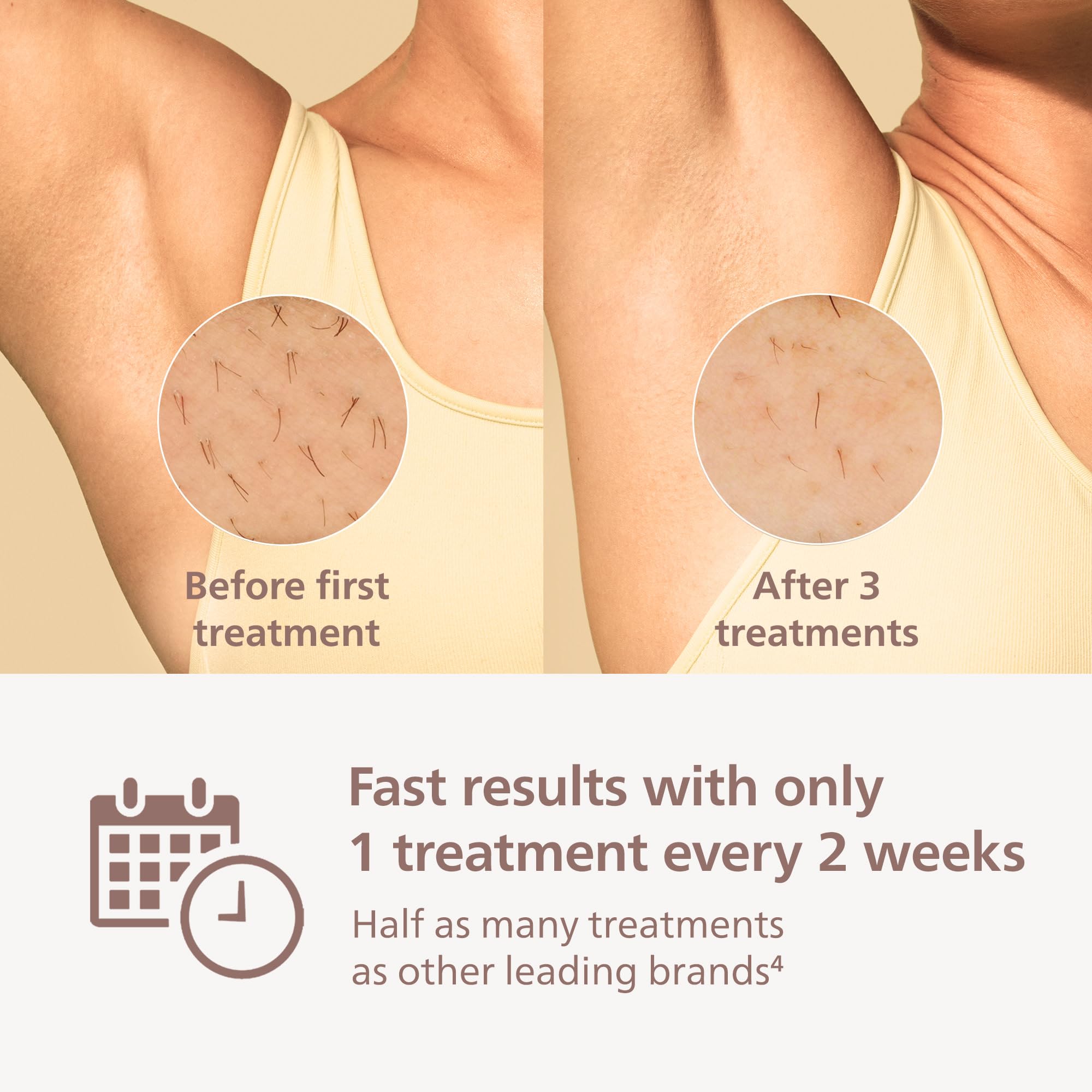 Philips Lumea 9000 underarms attachment in action for quick sessions