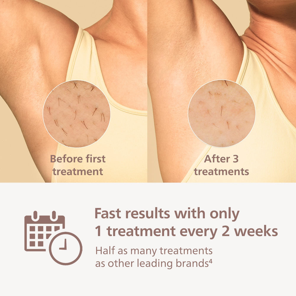 Philips Lumea 9000 underarms attachment in action for quick sessions