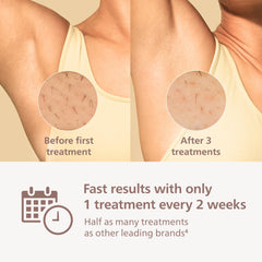 Philips Lumea 9000 underarms attachment in action for quick sessions