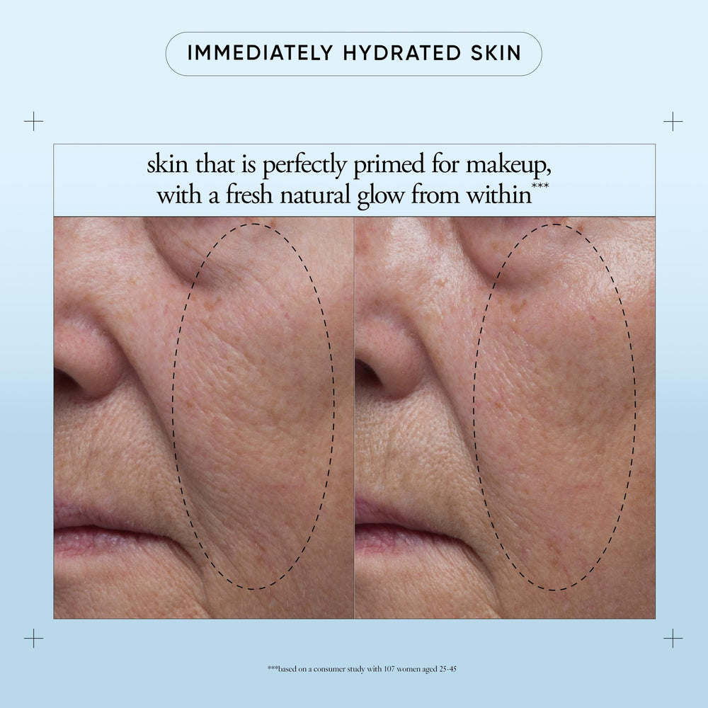 Philosophy Hope in a Jar open jar reveals hyaluronic acid and pineapple extract.
