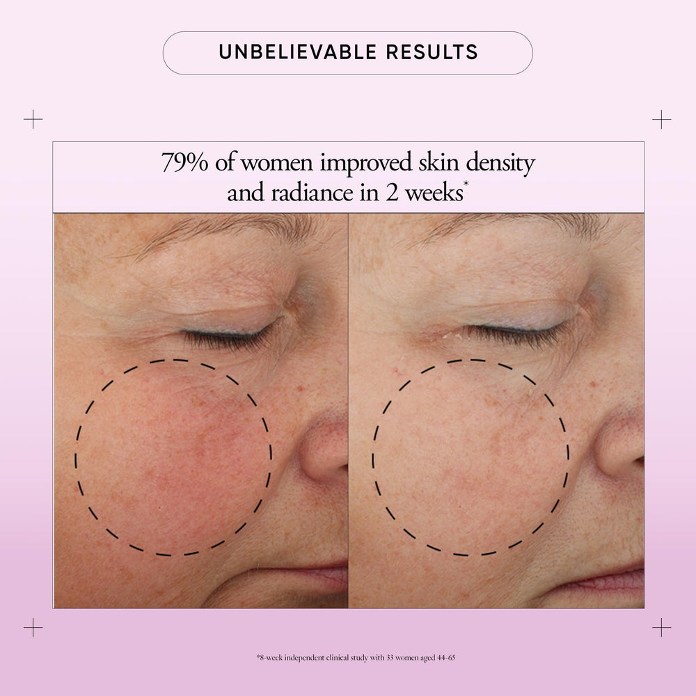 Philosophy Ultimate Miracle Worker jar closeup highlighting encapsulated retinol focus.