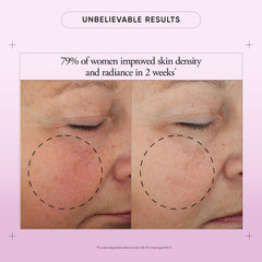 Philosophy Ultimate Miracle Worker jar closeup highlighting encapsulated retinol focus.