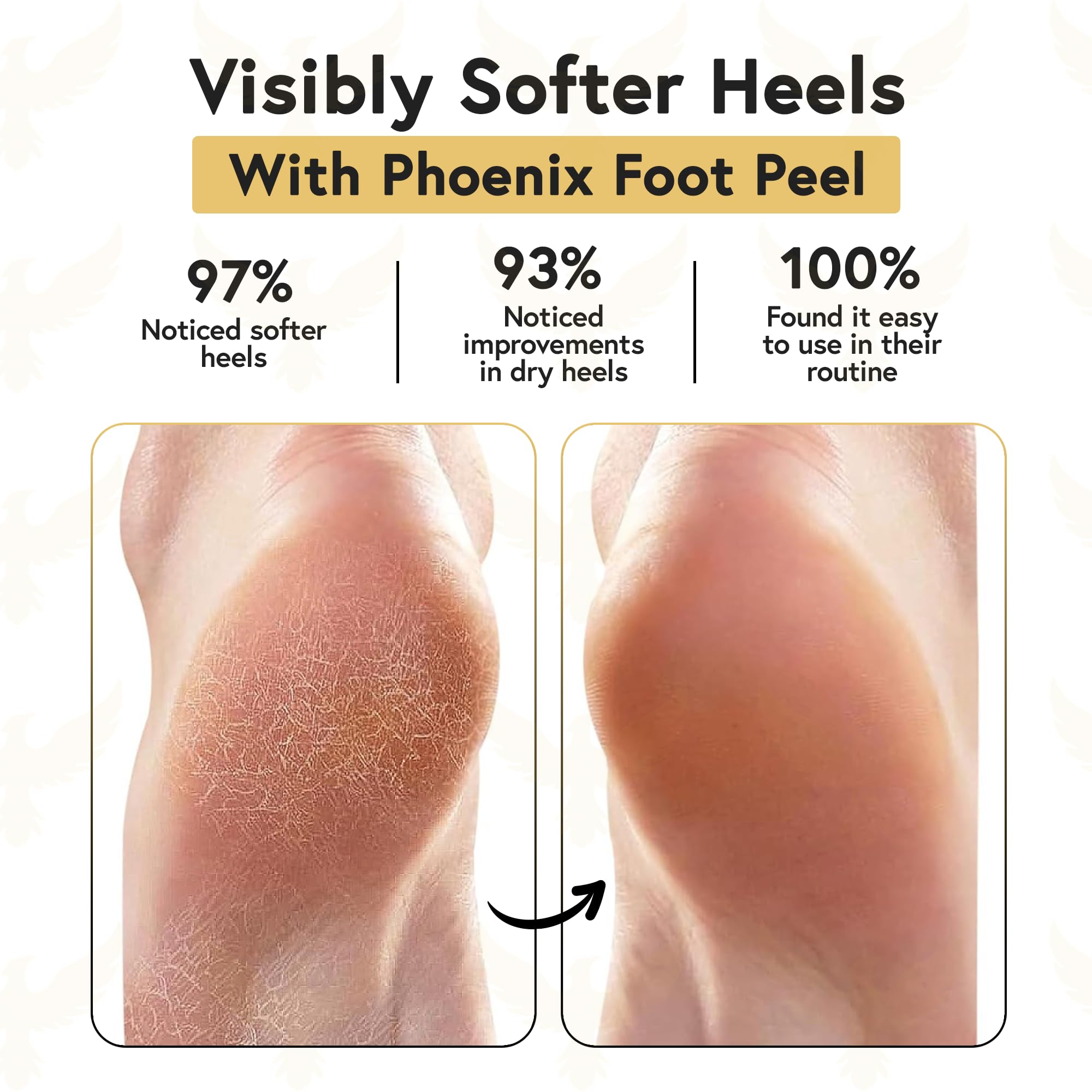 Phoenix Foot Peel calcetines gel silicona: calcetines que sellan humedad para pies suaves.