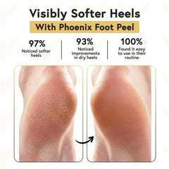 Phoenix Foot Peel calcetines gel silicona: calcetines que sellan humedad para pies suaves.