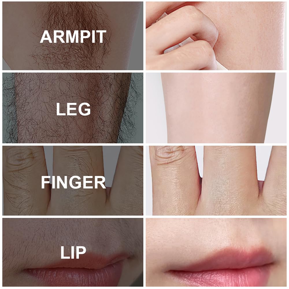 PHOFAY bikini area application demonstrating skin-friendly depilation.