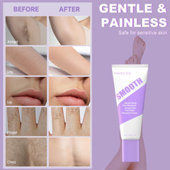 PHOFAY ingredients aloe and hyaluronic acid highlighted for skin comfort.