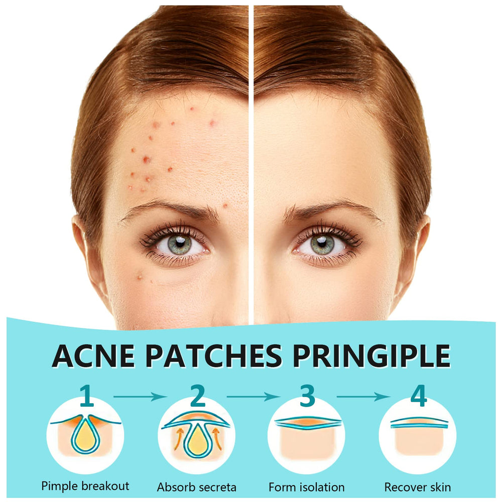 PICcircuit invisible patch on the cheek blending with skin for discreet coverage.