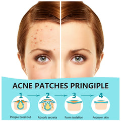 PICcircuit invisible patch on the cheek blending with skin for discreet coverage.