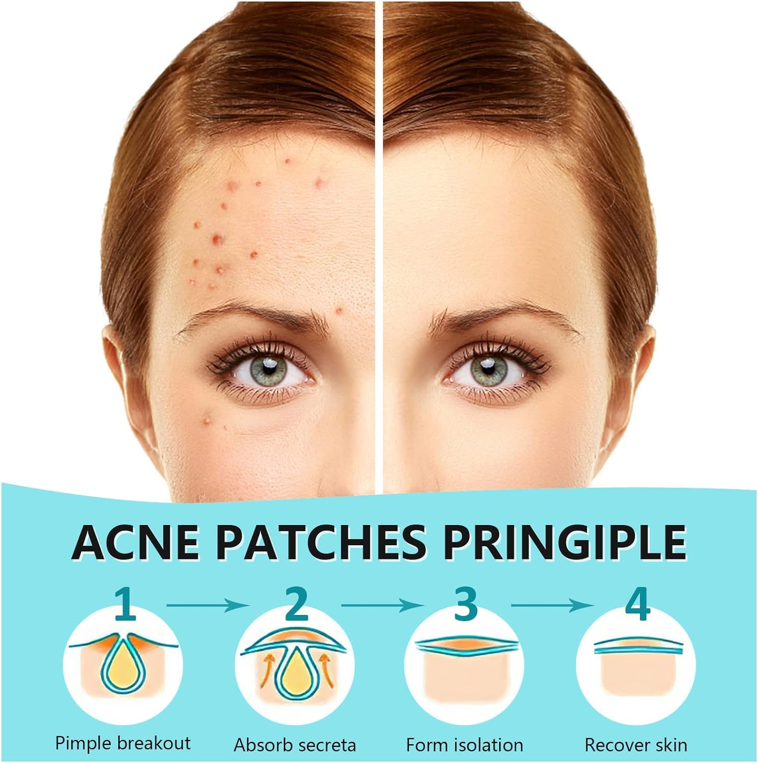 Parche hidrocoloide PICcircuit con adhesión fuerte para dormir toda la noche sin irritación