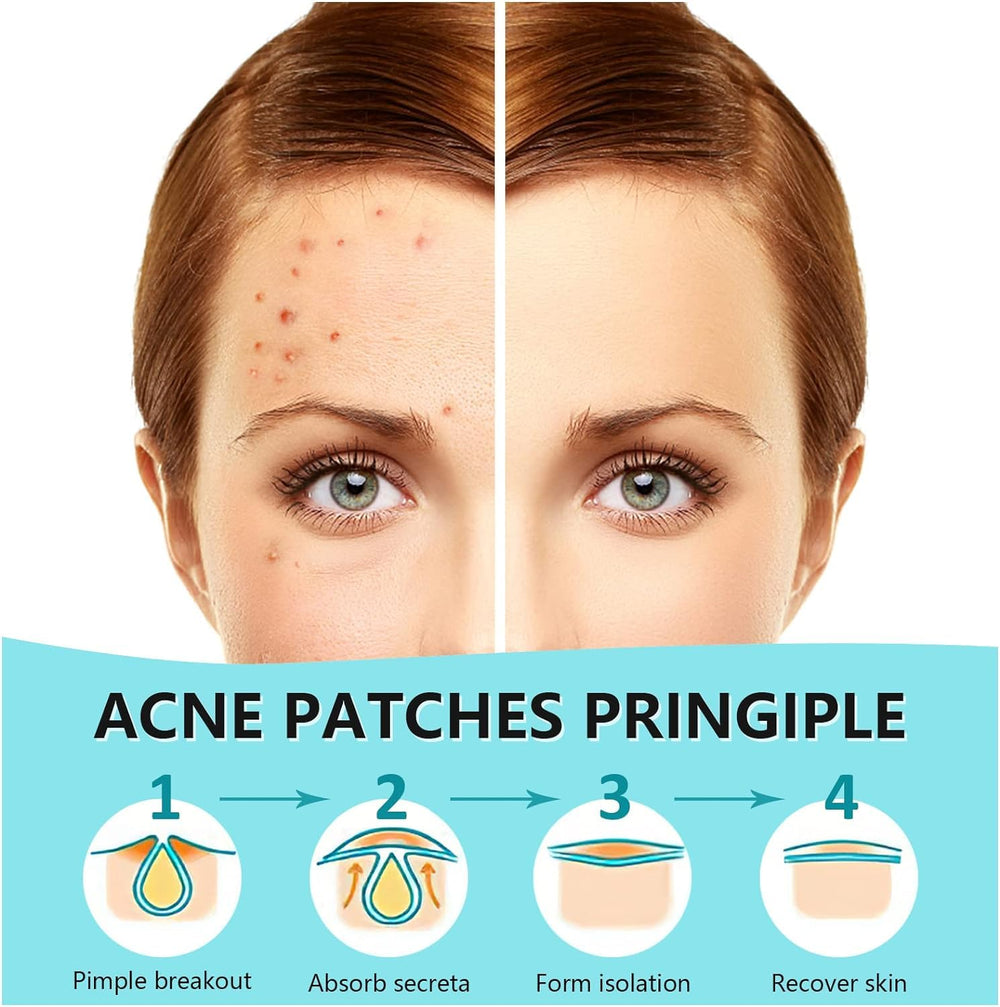 Parche hidrocoloide PICcircuit con adhesión fuerte para dormir toda la noche sin irritación