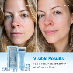 Plantifique Facial Ice Roller soothes the eye area with cooling relief.