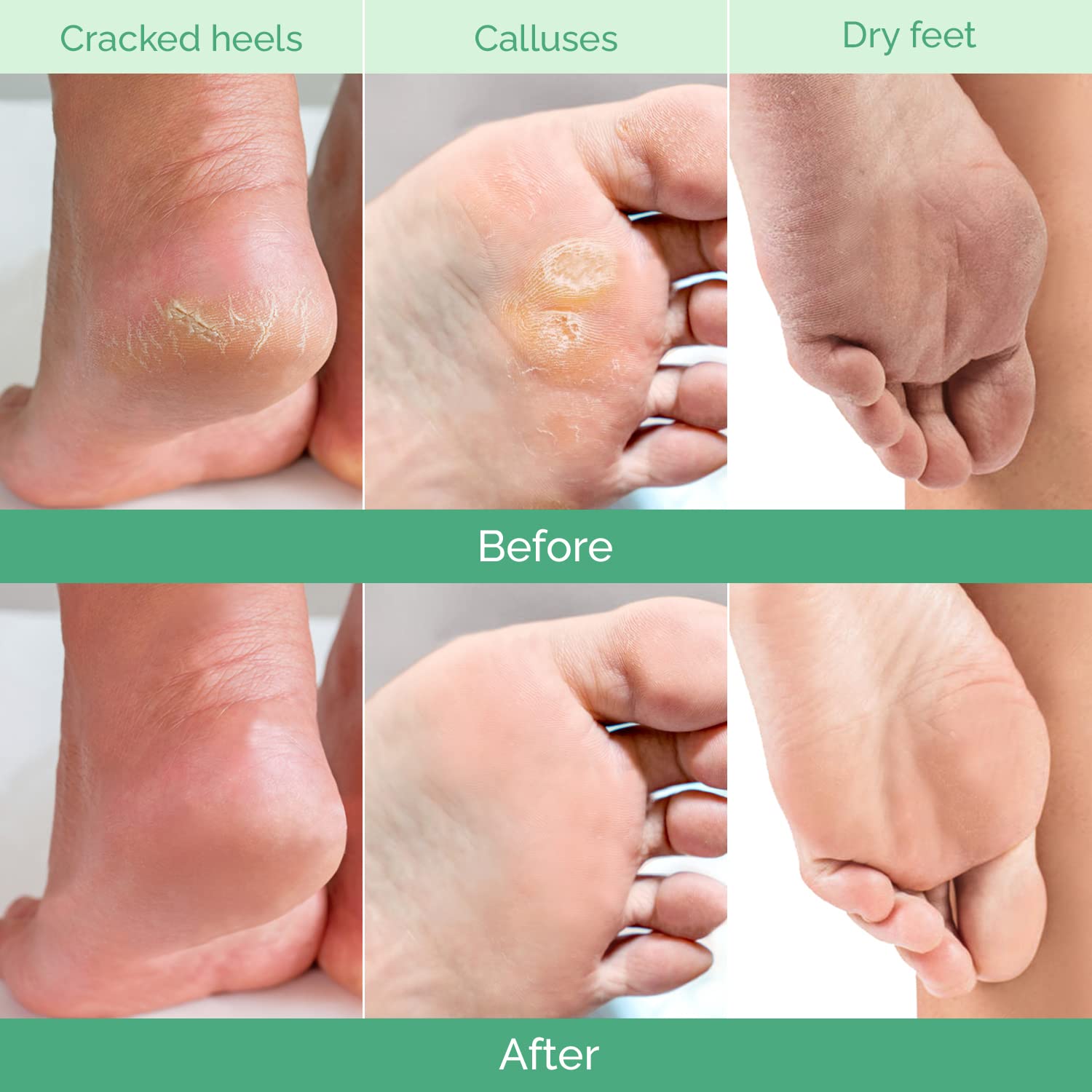 PLANTIFIQUE Foot Peel Mask application-step shows easy three-step treatment.