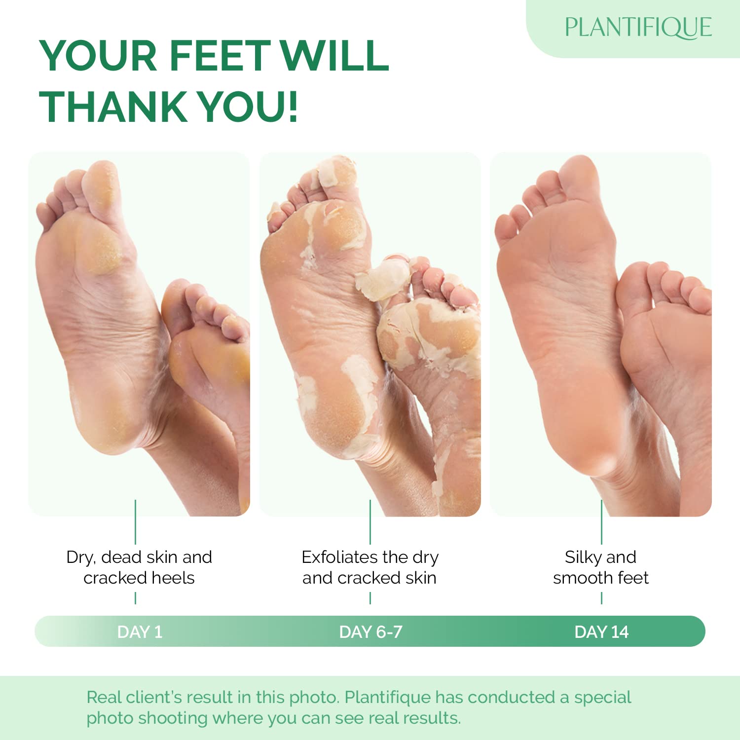 PLANTIFIQUE Foot Peel Mask soak-step demonstrates pre-soak to soften calluses.
