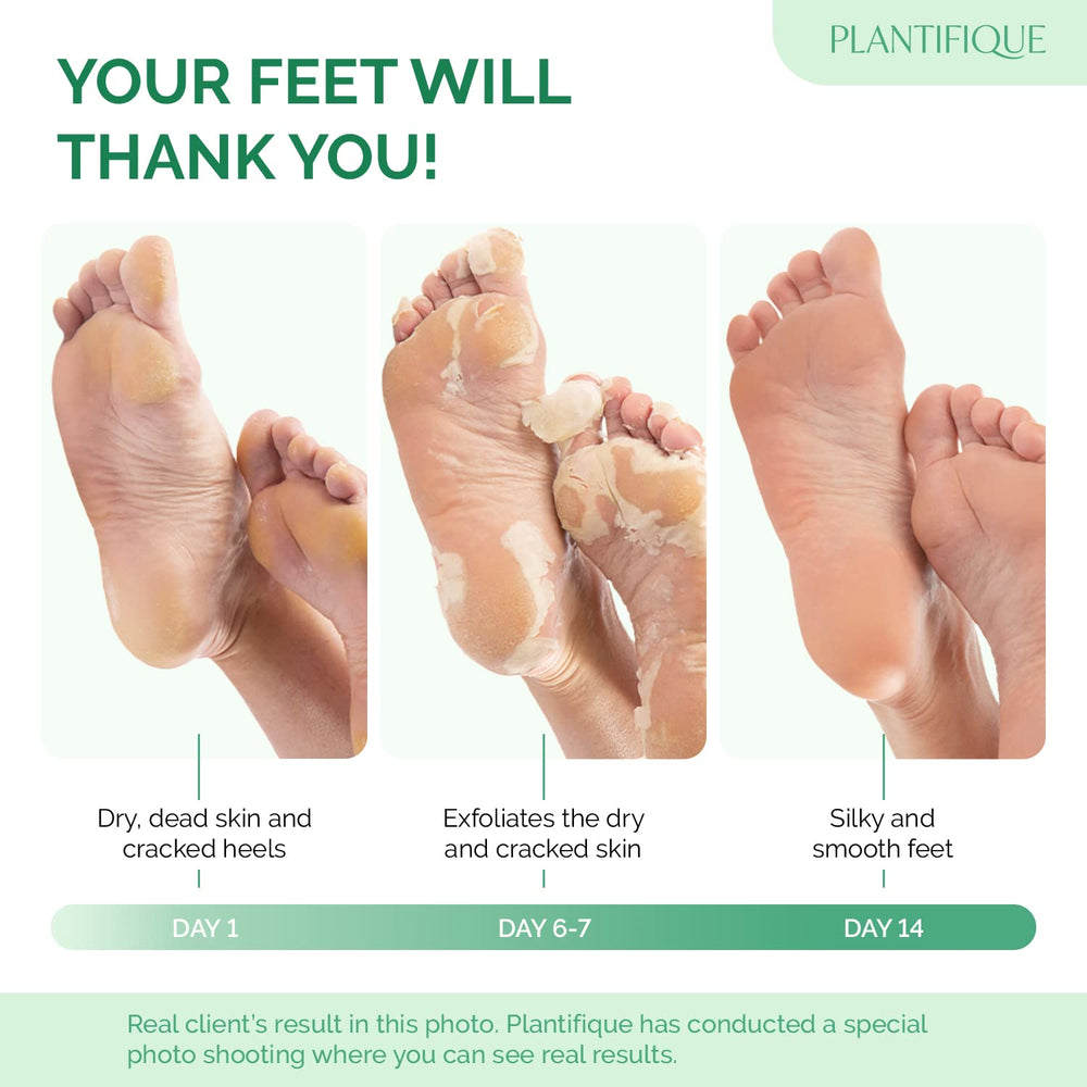 PLANTIFIQUE Lavender Foot Peel Mask in use on the foot for gentle exfoliation