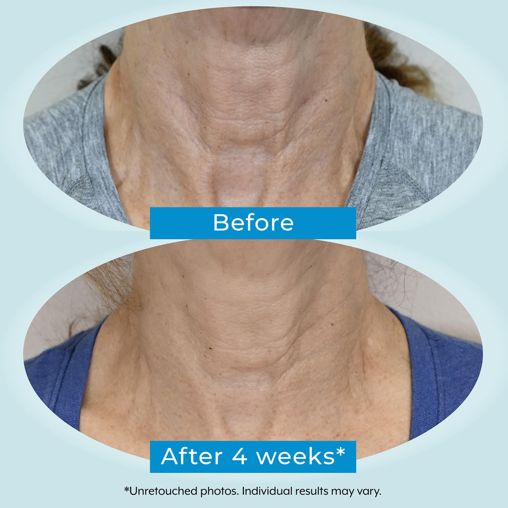 Plexaderm neck-cream texture close-up indicating smooth, even application.