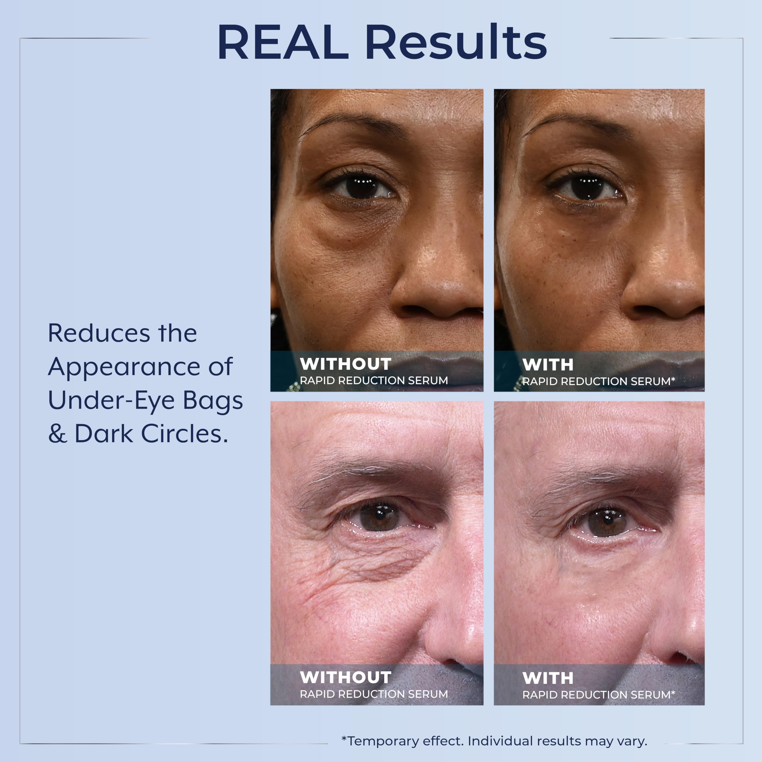 Before and after style shot hints at instant-looking tightening around the eyes.