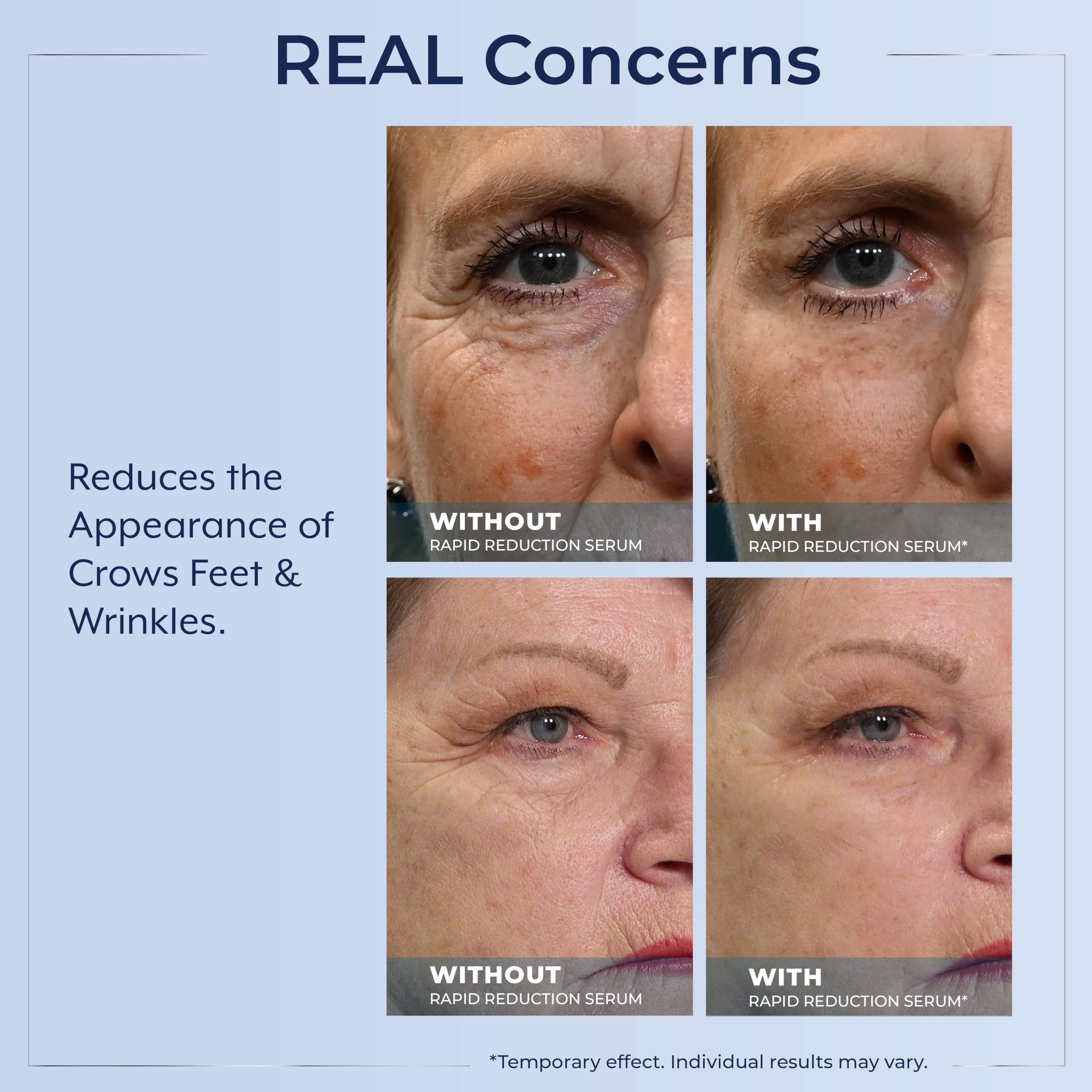 Plexaderm under-eye application with even coverage.