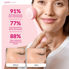 PMD Beauty Waterproof Design enables easy cleansing in wet or damp conditions