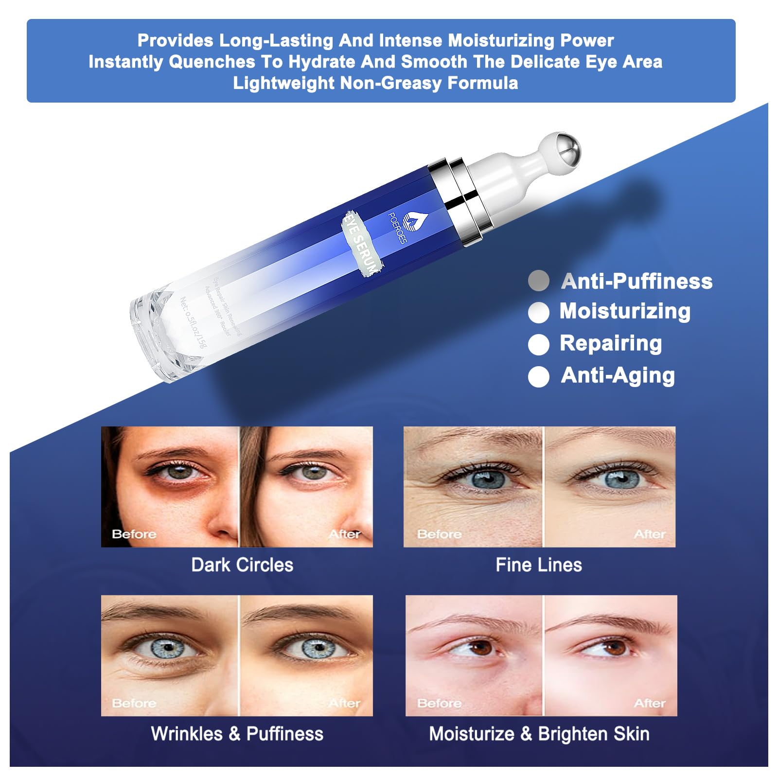 POEROES eye serum under-eye close-up highlights puffiness reduction potential.