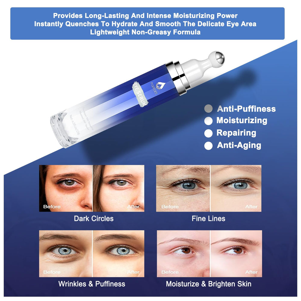 POEROES eye serum under-eye close-up highlights puffiness reduction potential.